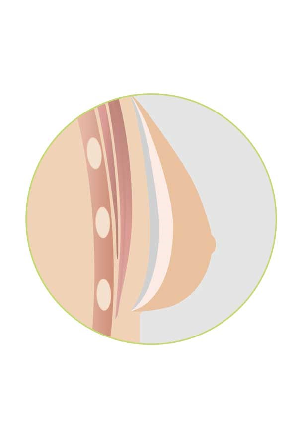 natura-breast-form-profile natura-breast-form-profile